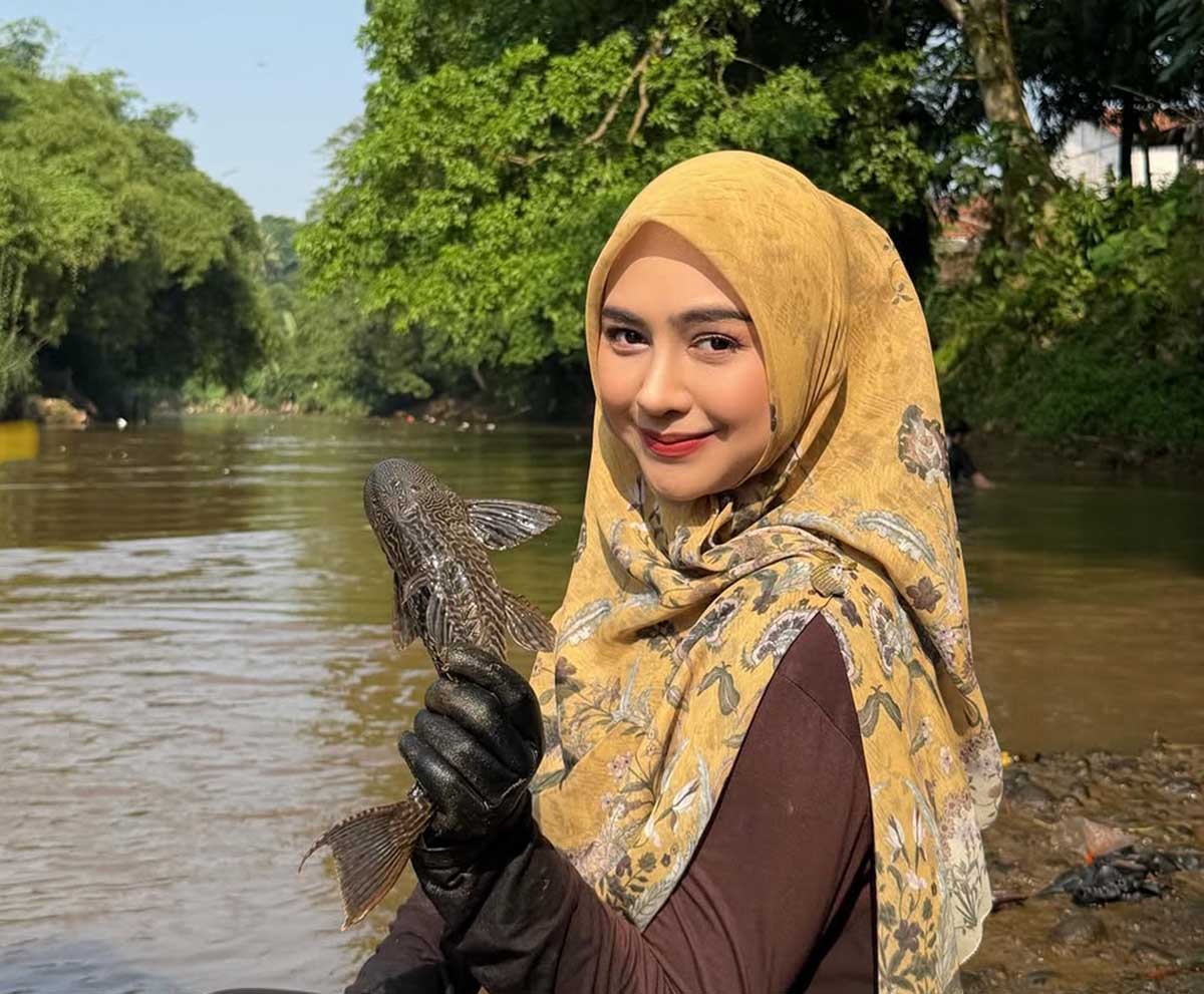Ria Ricis Buka-bukaan Soal Operasi Hidung, Bukan Demi Cantik, Tapi Karena Masalah Kesehatan